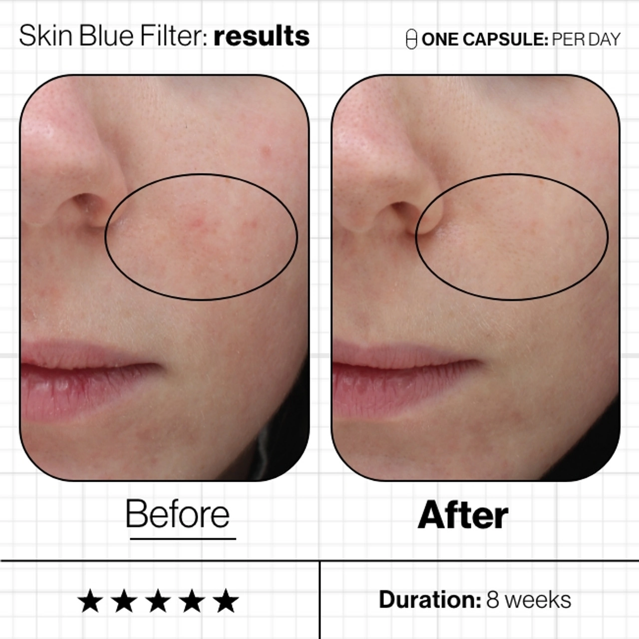 Skin-Blue-Filter-Before—After__93598