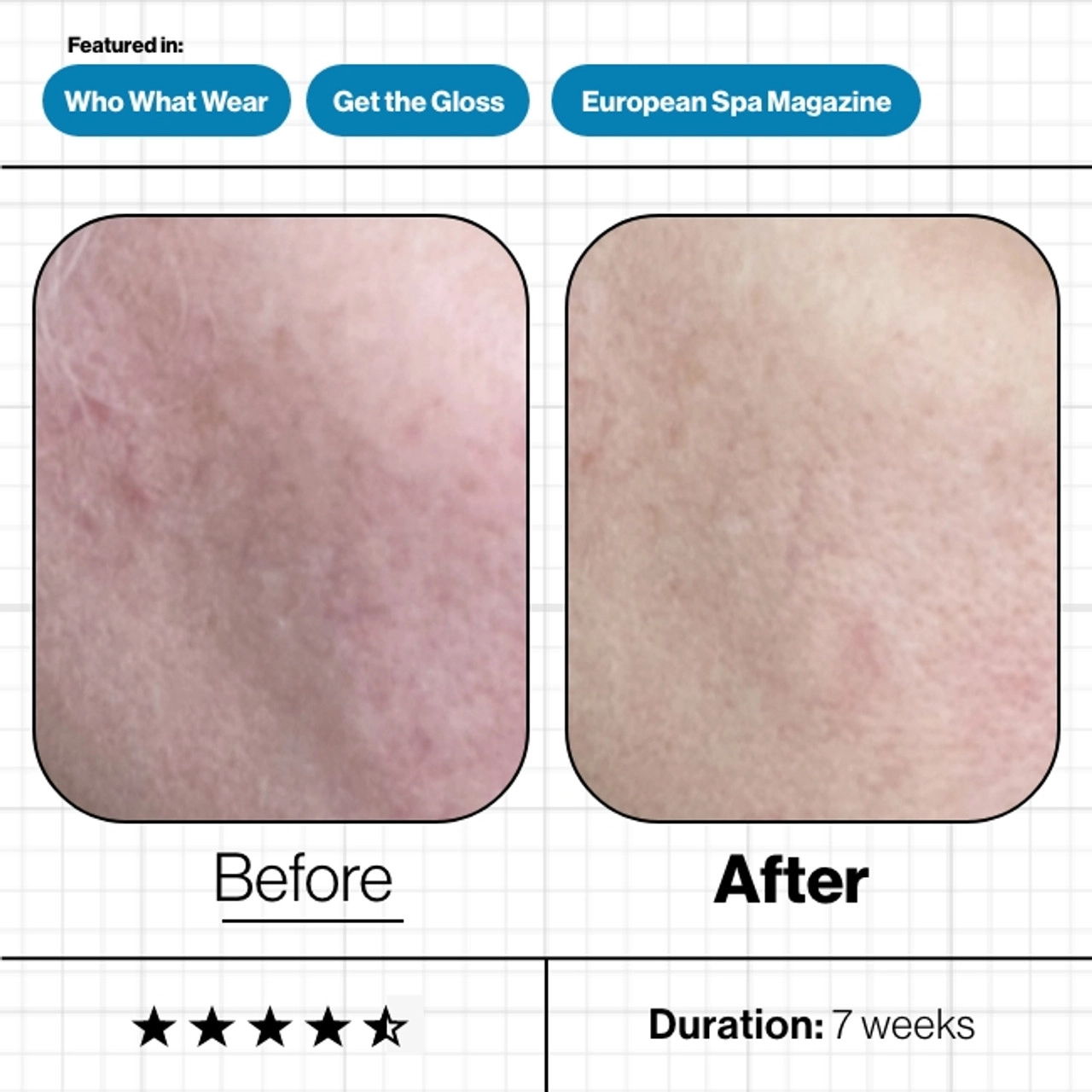 Skin_Moisture_IQ_3__71898