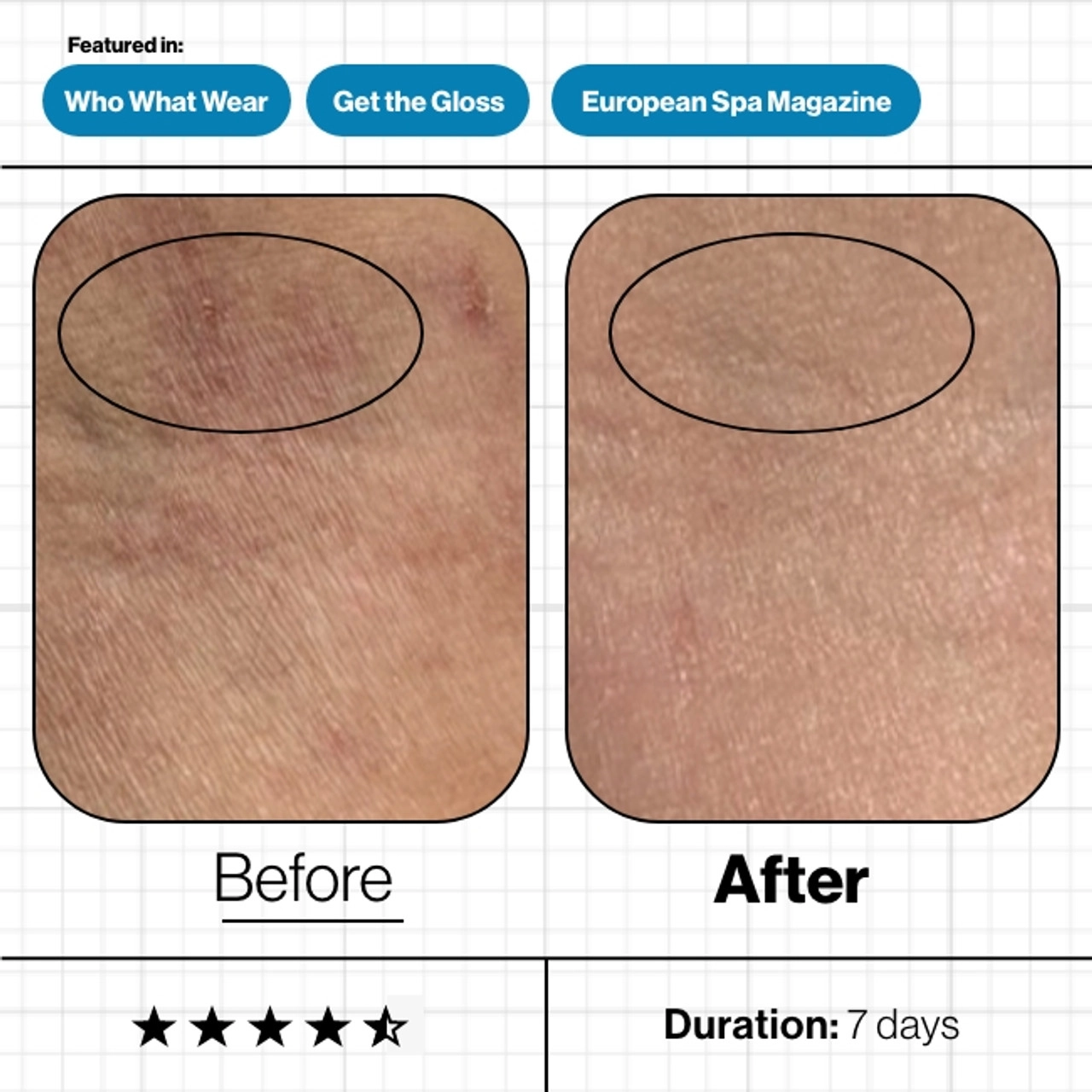 Skin_Moisture_IQ_7__30281