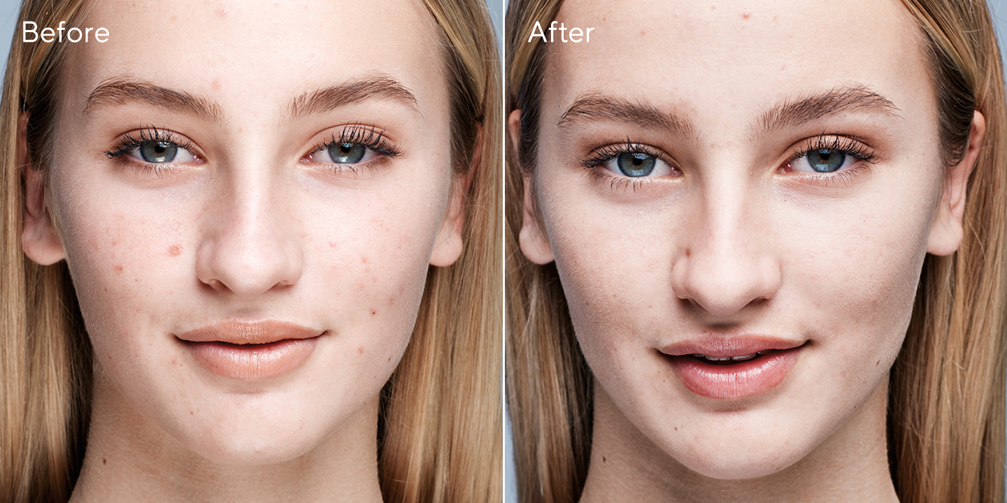Outsmart_Blemish_Before&After1